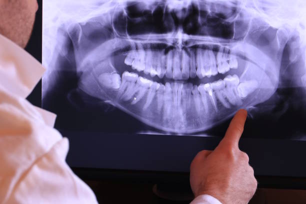 Best Urgent Dental Care for Toothache in Agua Dulce, CA